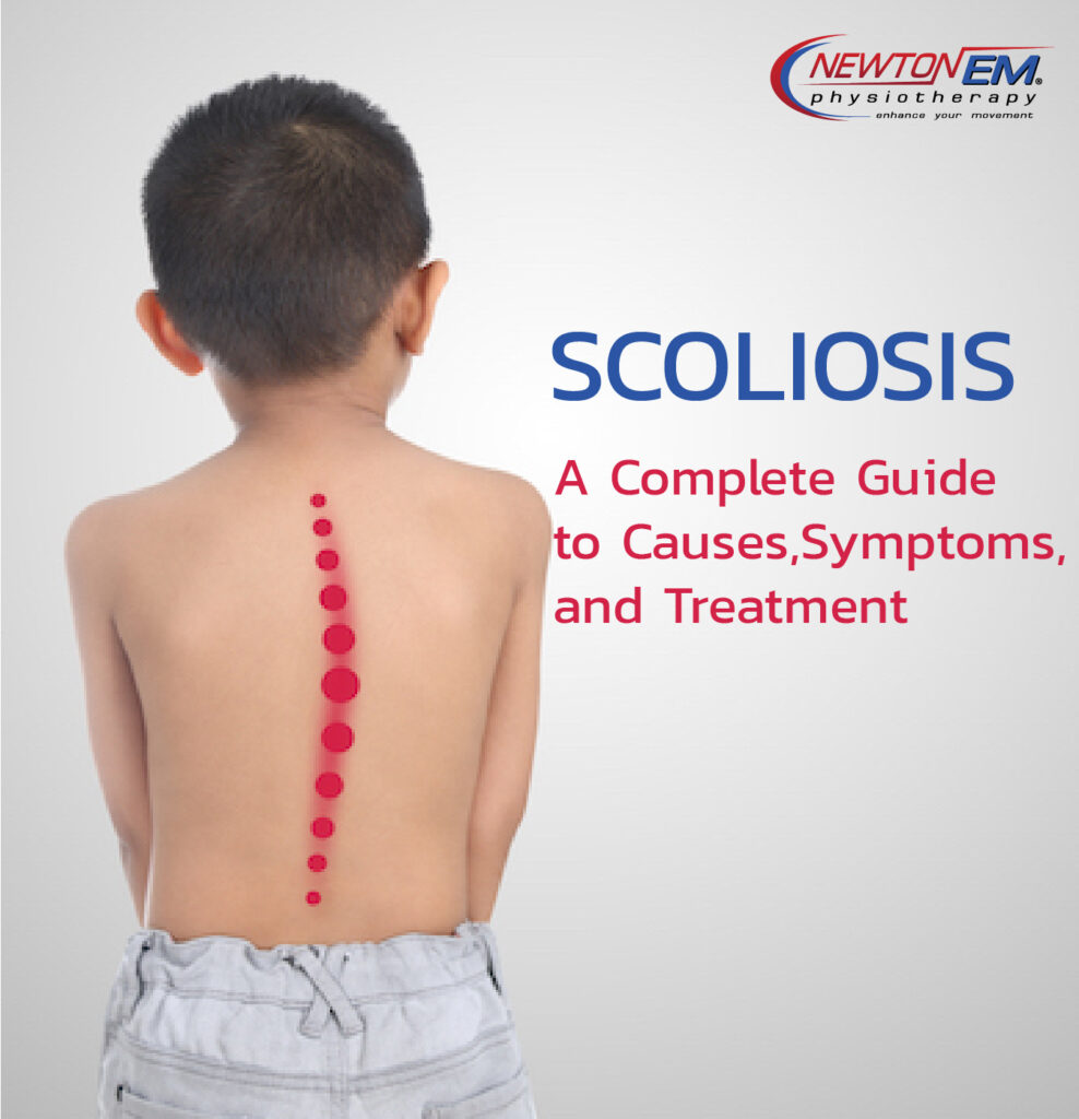 Scoliosis: A Complete Guide to Causes, Symptoms, and Treatment