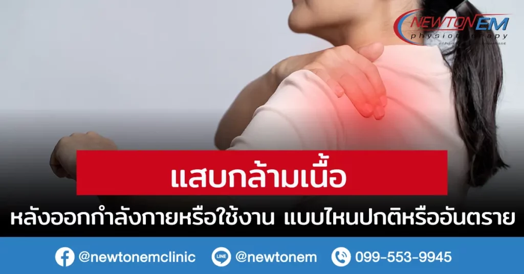 แสบกล้ามเนื้อ หลังออกกำลังกายหรือใช้งาน แบบไหนปกติหรืออันตราย