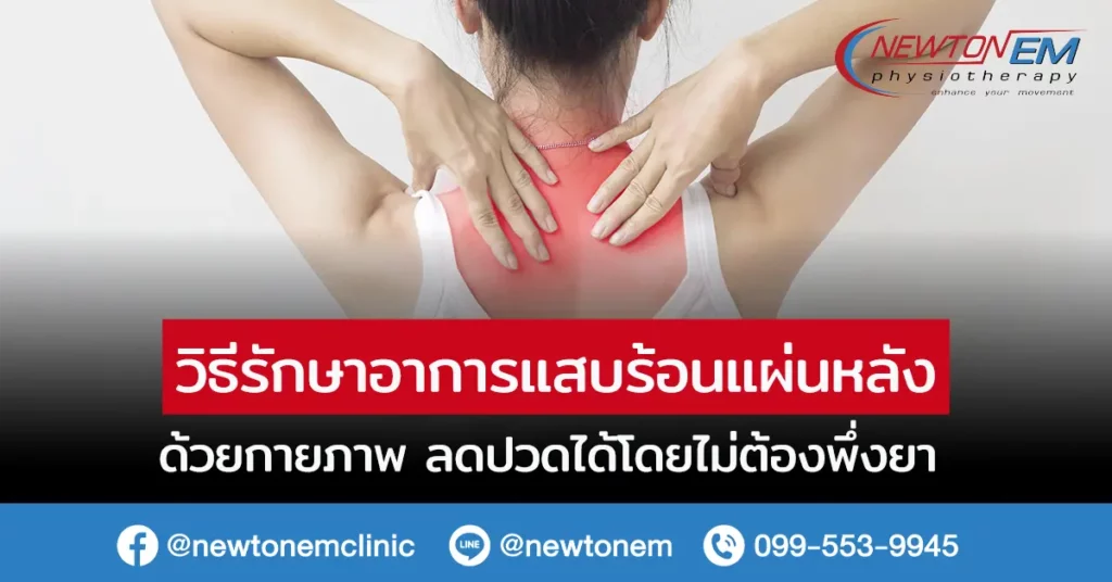 วิธีรักษาอาการแสบร้อนแผ่นหลัง ด้วยกายภาพ ลดปวดได้โดยไม่ต้องพึ่งยา